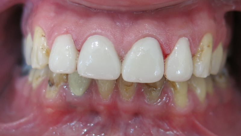 Lodi Family Dentistry | Digital Radiography, CBCT and ClearCorrect®