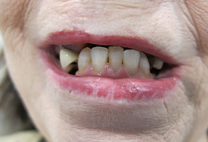 Lodi Family Dentistry | Snoring Appliances, CBCT and Digital Radiography