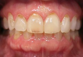 Lodi Family Dentistry | Periodontal Treatment, TMJ Disorders and Implant Dentistry