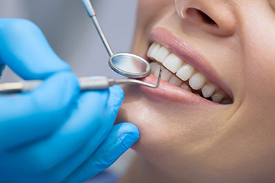 Lodi Family Dentistry | Preventative Program, Veneers and Implant Dentistry