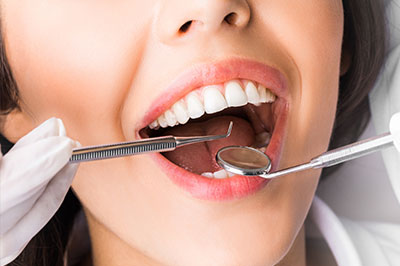 Lodi Family Dentistry | Dental Fillings, CBCT and Night Guards