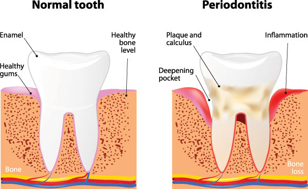 Lodi Family Dentistry | ClearCorrect reg , Sleep Apnea and Emergency Treatment