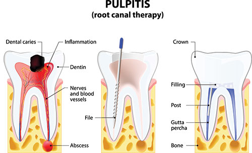 Lodi Family Dentistry | CEREC, 4-Implant Smile and Snoring Appliances