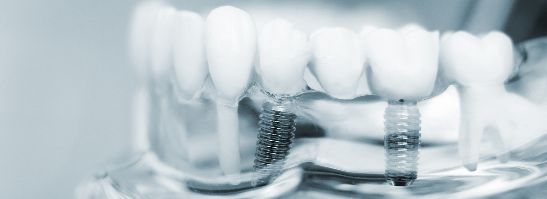 Lodi Family Dentistry | Oral Cancer Screening, Veneers and CBCT